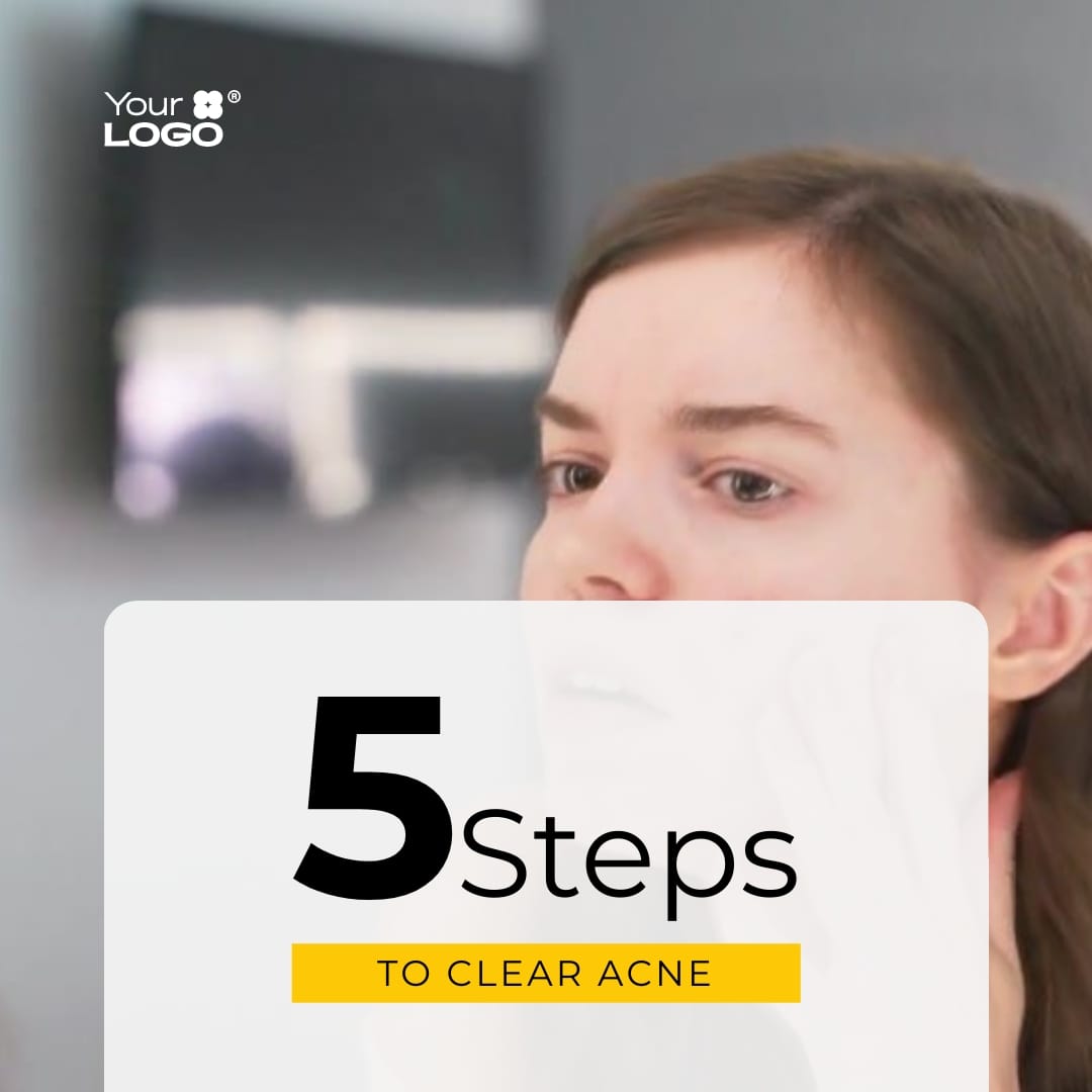 Sleek Steps to Help Clear Acne Listicle Video Square Template